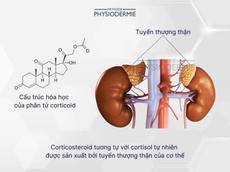 3 bước tối giản chữa da bị nhiễm corticoid tại nhà Methode Physiodermie