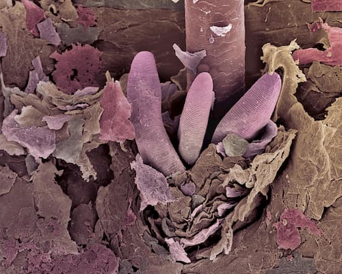 Tất tần tật về Demodex triệu chứng và cách điều trị, xét nghiệm Demodex ở đâu? 2 Ký sinh trùng demodex sống và sinh sản trong tuyến bã nhờn - Demodex triệu chứng