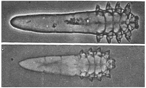 Ve Demodex - Sát Thủ Thầm Lặng Của Làn Da 1 Hình ảnh ký sinh trùng demodex dưới kính hiển vi