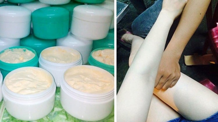 Cô gái Hỏng Mặt vì dùng kem trắng da không rõ nguồn gốc 2 Kem trắng da không nguồn gốc