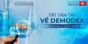 demodex trieu chung 1