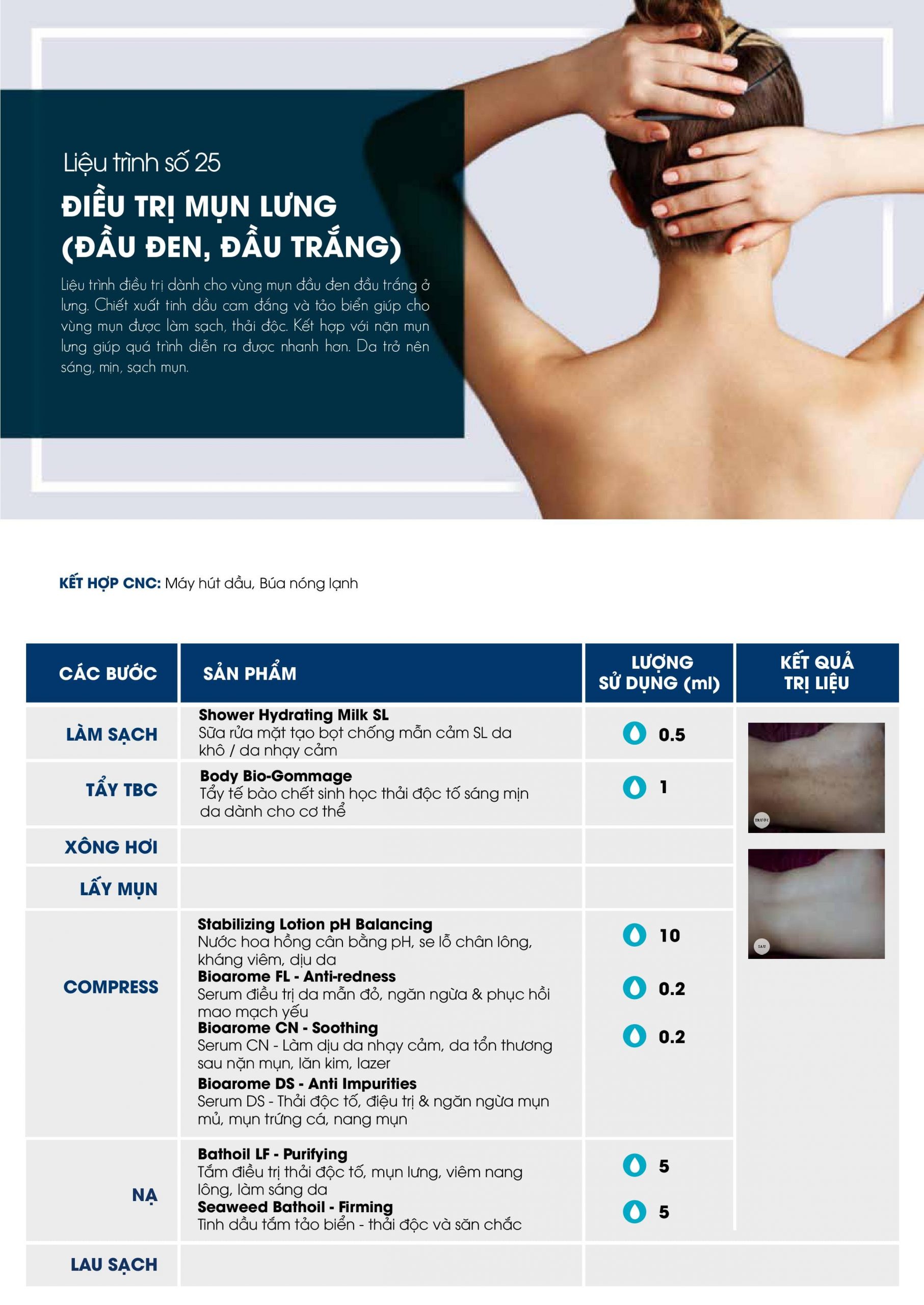 Liệu trình dịch vụ
