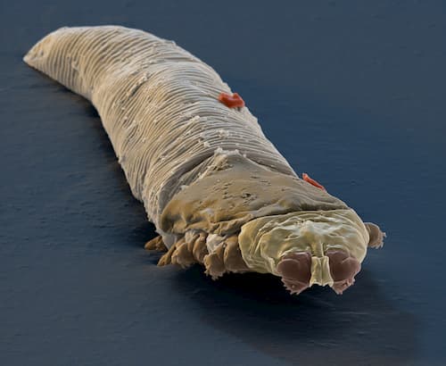 Demodex gây mụn! Dấu hiệu da bị nhiễm Demodex & Mẹo điều trị 2 Hình ảnh ký sinh trùng demodex gây mụn qua kính hiển vi