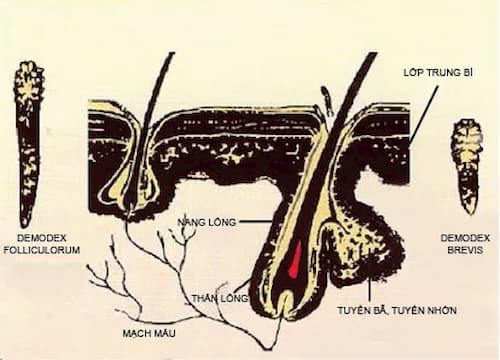 Giải mã Bệnh Demodex là bệnh gì? 2 Vị trí Demodex sinh sống (vệt đỏ)