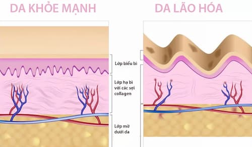 Mặt nạ ngủ giúp tăng khả năng tổng hợp collagen lên gấp đôi