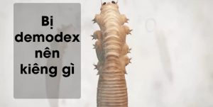 bị demodex nên kiêng gì