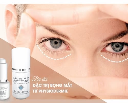 Bọng mắt to khi cười là nét duyên ngầm hay biểu hiện bệnh lý? 4 Bộ đôi đặc trị bọng mắt khi cười