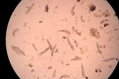 Ký sinh trùng demodex có kích thước rất nhỏ