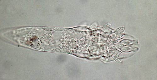 Hình ảnh ký sinh trùng demodex