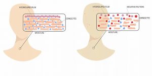 cach-khoi-phuc-lop-mang-hydrolipid-khi-bi-ton-thuong