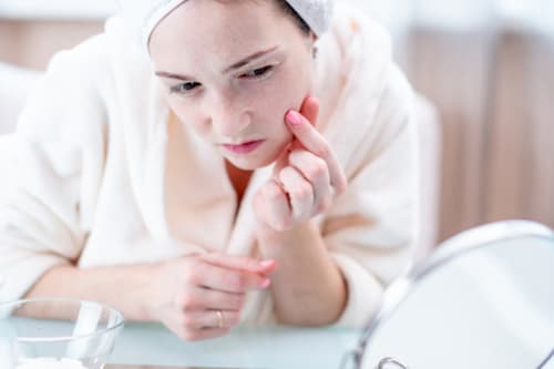 Mặt nạ ngủ Skin Care và 4 Hậu Quả khôn lường khi lạm dụng 4 Khi lớp màng bảo vệ da yếu đi dễ hình thành nên mụn