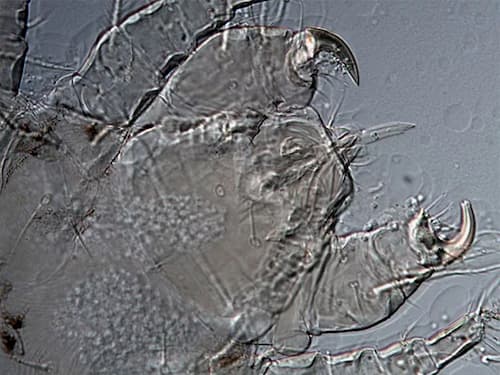 Dùng thuốc trị Demodex cho người HAY dược mỹ phẩm đặc trị? 1 Ký sinh trùng Demodex có miệng sắc nhọn để đâm sâu vào da lấy thức ăn