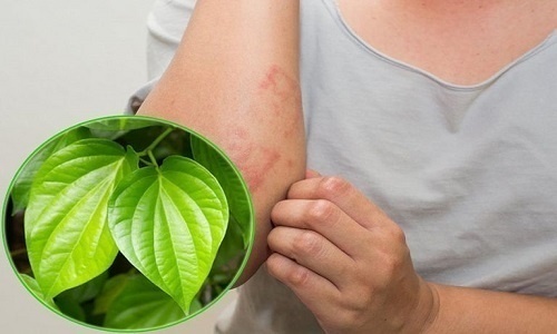 Điều trị viêm lỗ chân lông ở bắp tay có gì?! 1 Điều trị viêm lỗ chân lông bằng phương pháp tự nhiên có "ổn" không?