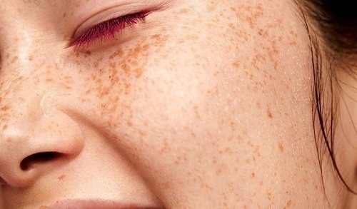 Dầu dưỡng tầm xuân Revit (A) Oil - Bí quyết chống lão hóa cho làn da tuổi trung niên 2 Retinoids được biết đến với khả năng làm giảm sắc tố melanin