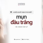 nhận biết mụn đầu trắng và cách xử lý