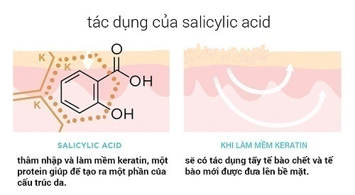 Tổng quan về mụn mủ và các thành phần điều trị mụn hiệu quả 3 Salicylic acid