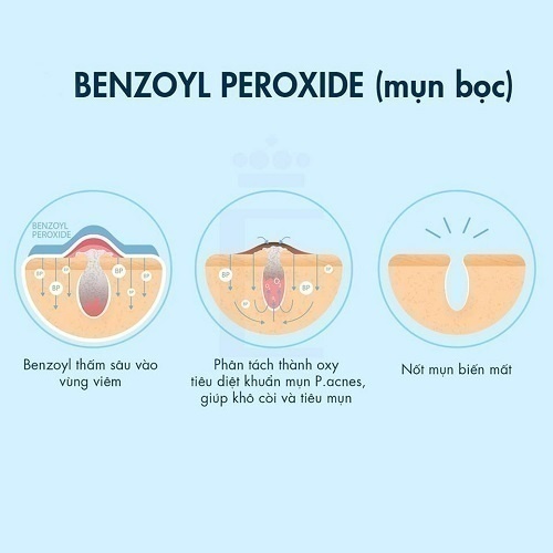 Cơ chế hoạt động của Benzoyl peroxide