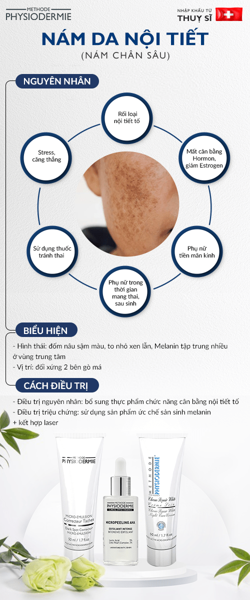 Phân biệt các loại nám da phổ biến 1 Các loại nám da phổ biến - Nám chân sâu
