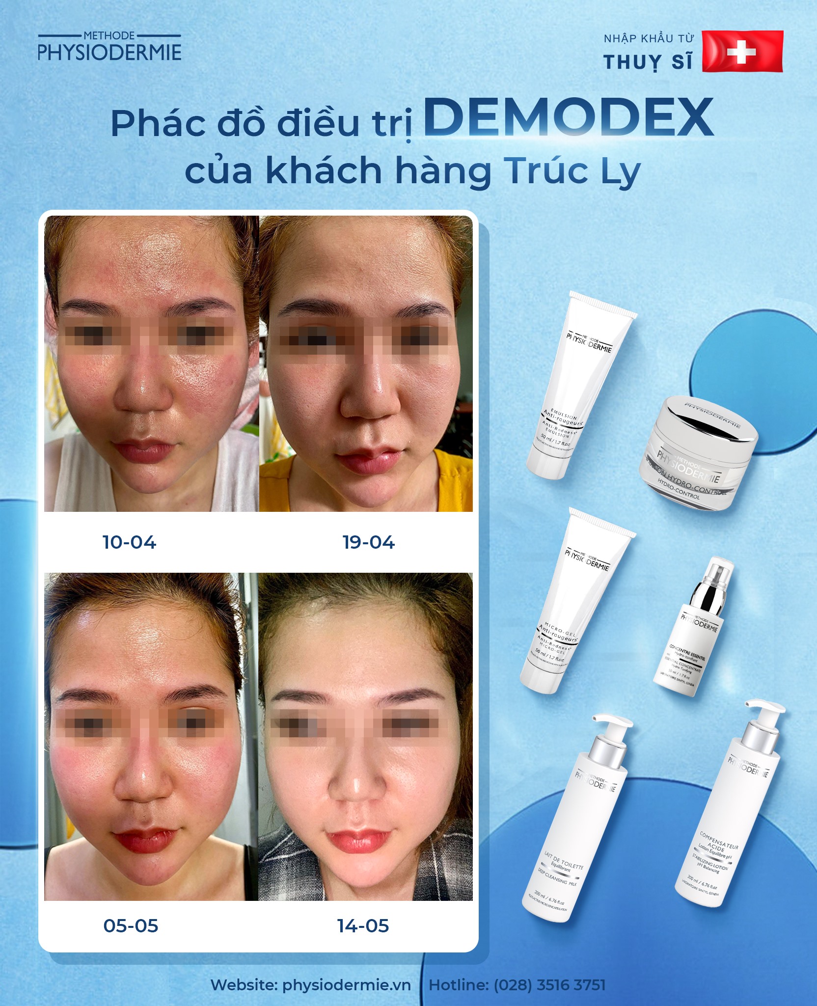 Phác đồ điều trị Demodex
