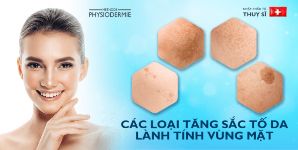 Tăng sắc tố sau viêm - Nguyên nhân & phương pháp điều trị