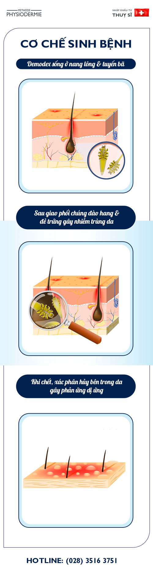 Viêm da Demodex & hiểm họa do dùng mỹ phẩm kém chất lượng 1 Cơ chế sinh bệnh viêm da demodex