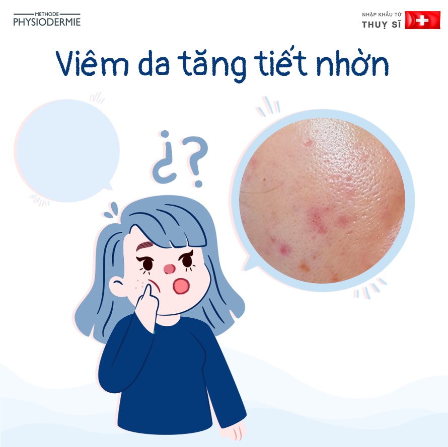 Cách Điều Trị Da Bị Nhiễm Corticoid Mức Độ Nặng 2 Viêm da tăng tiết nhờn