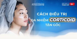 cach-dieu-tri-da-nhiem-corticoid-thumbnail