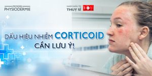 dấu hiệu nhiễm corticoid