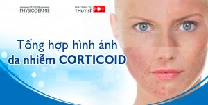 da bị nhiễm corticoid