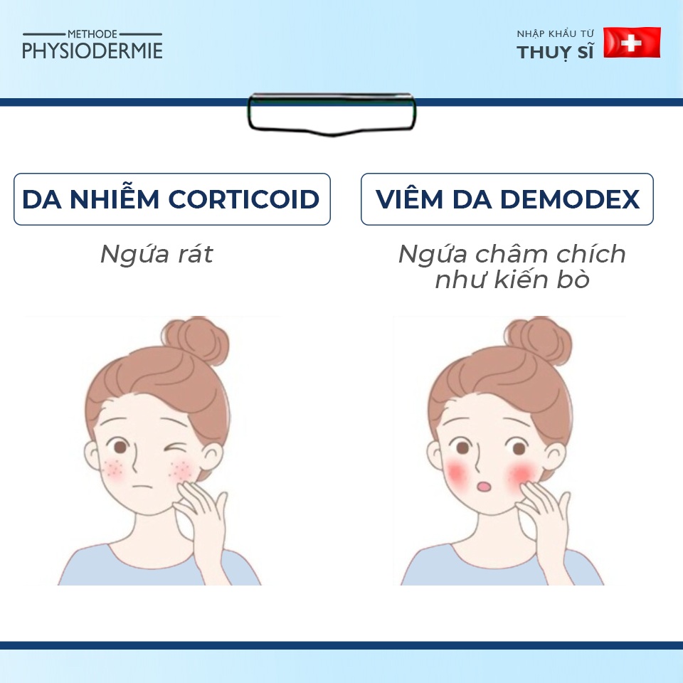 Phân biệt biểu hiện Da bị nhiễm Corticoid và Viêm da Demodex 2 Cảm giác ngứa là biểu hiện da bị nhiễm corticoid và viêm da demodex thường gặp nhất