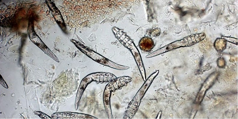 Ký sinh trùng demodex dưới kính hiển vi