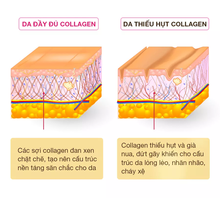 Collagen trên da