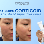 phuc-hoi-da-nhiem-corticoid-cung-bac-i-da-lieu