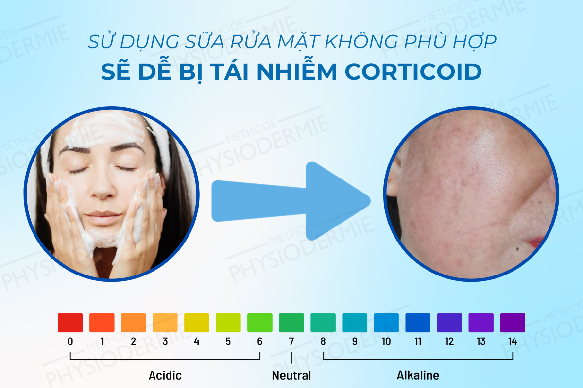 Sữa rửa mặt sẽ ảnh hưởng rất nhiều đến độ pH của da và có nguy cơ tái nhiễm corticoid