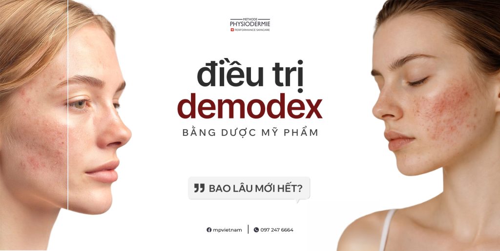 Điều Trị Demodex Bằng Dược Mỹ Phẩm Bao Lâu Mới Hết? 5 dieu-tri-demodex-bang-duoc-my-pham-bao-lau-moi-het
