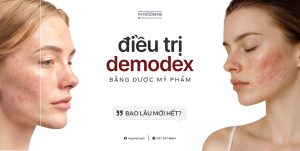 dieu-tri-demodex-bang-duoc-my-pham-bao-lau-moi-het