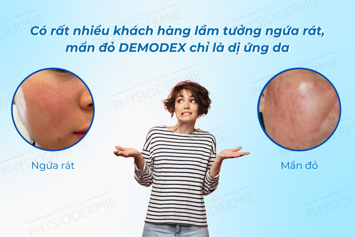 Ngứa rát và mẩn đỏ là một trong những dấu hiệu bị viêm da demodex