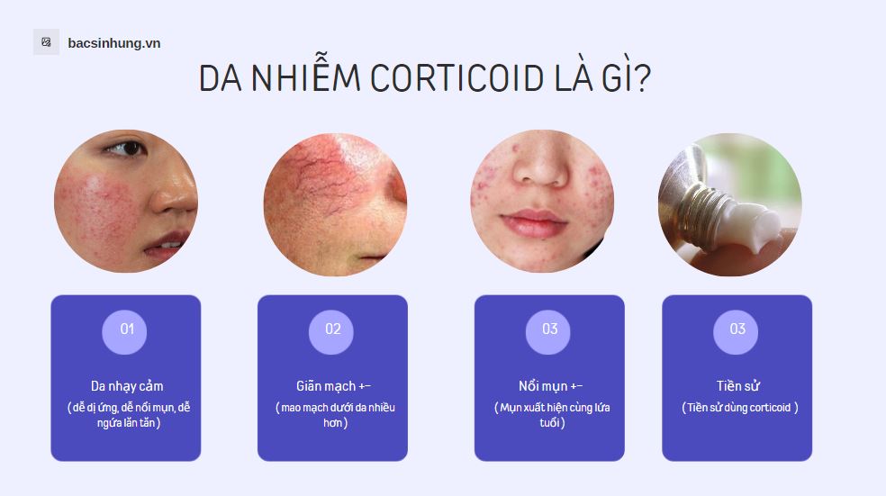 Một số tình trạng da nhiễm corticoid mà chúng ta thường gặp
