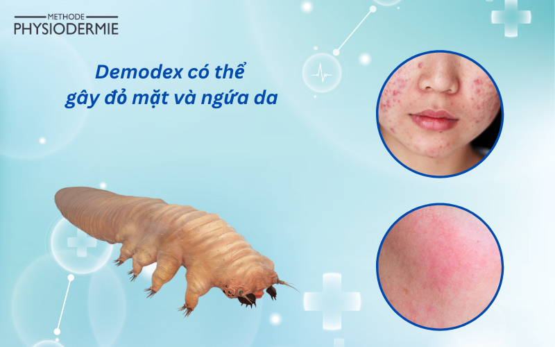 demodex có thể gây đỏ mặt và ngứa da
