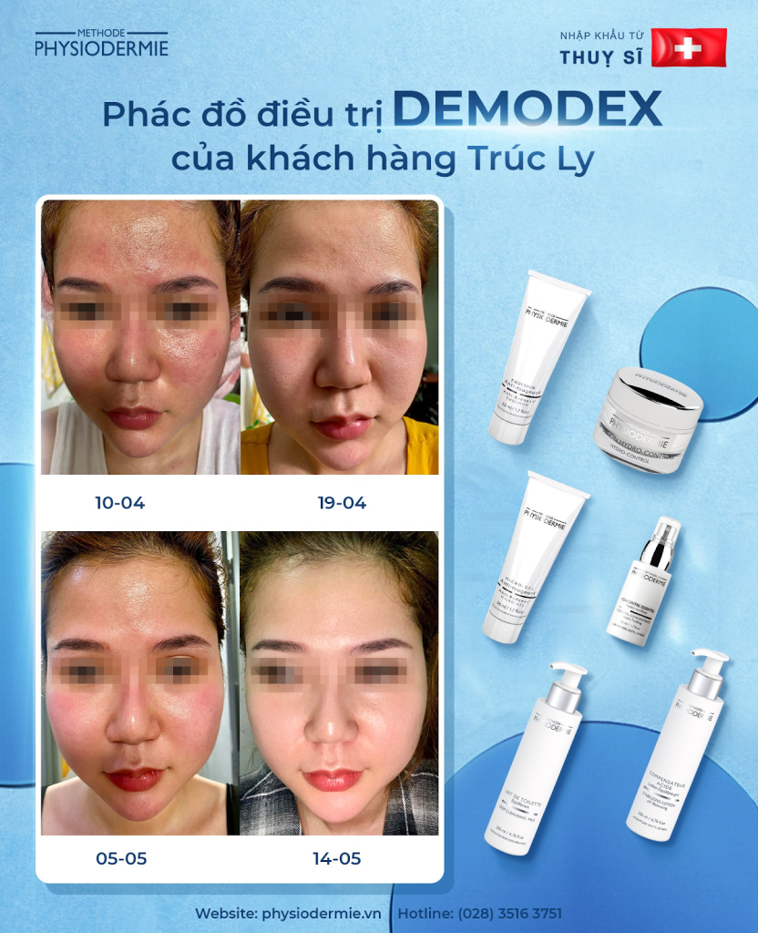 Ket qua lam sang cua khach hang dieu tri da nhiem Demodex