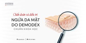 SEO Ngua mat do demodex 1012