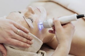 Giai phap thay the Retinol trong dieu tri tang sac to do la phuong phap ban tia laser