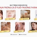 SEO Cham soc da mun trung ca 0905