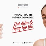 SEO Tri demodex 3005