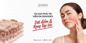 SEO Tri demodex 3005