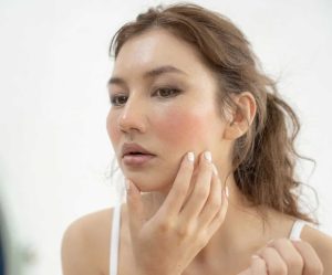 Su dung Retinol khong dung cach da de bi kich ung noi man do