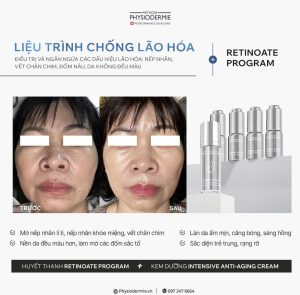 ket qua cua khach hang khi dung huyet thanh retinol voi muc dich tre hoa da