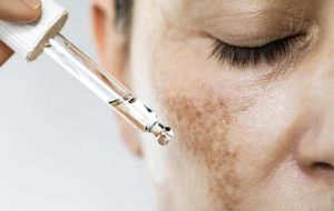 co giai phap thay the retinol 0 5 khong