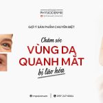 SEO Cham soc da quanh mat 0307