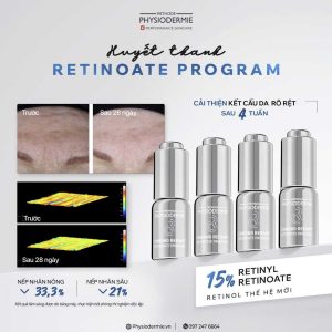 hieu qua cua huyet thanh retinol duoc chung minh lam sang tren lan da lao hoa